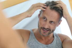 Middle aged man concerned by hair loss