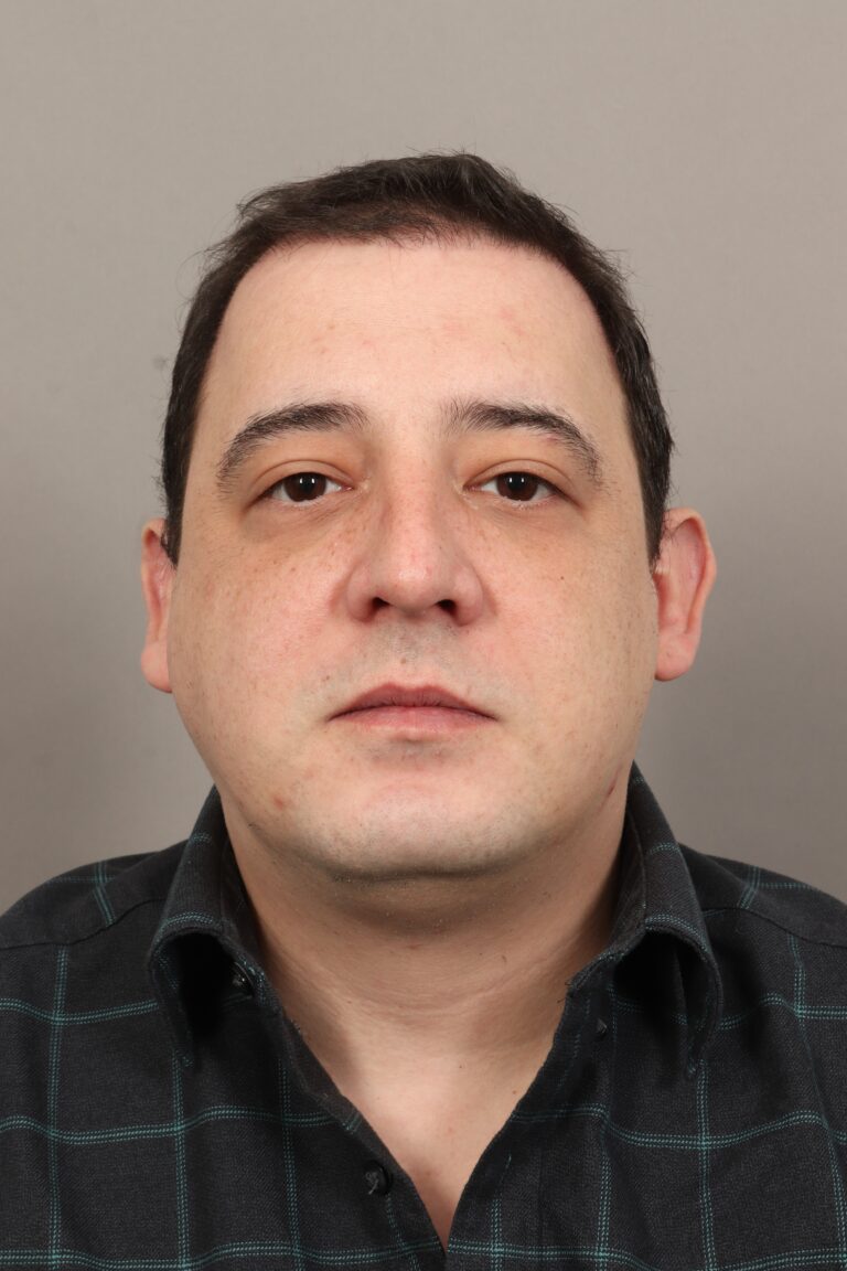 After Image: Male NeoGraft (5 Months Post-Op) - front